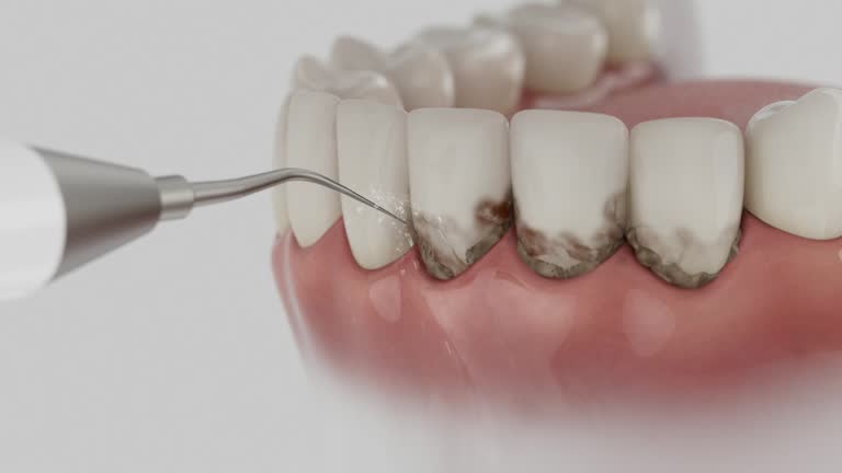Trusted Wisdom Tooth Removal service in Geraldine, AL - Dentist Open Now